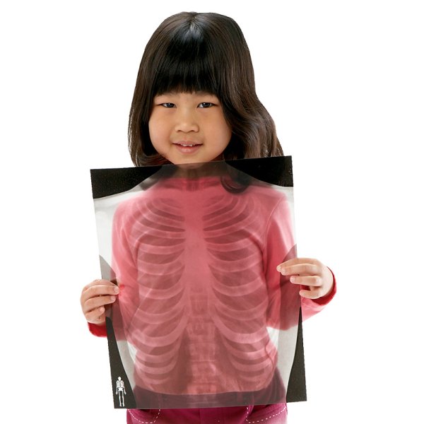 X-Ray Images "Human", life-size, 18 pcs.